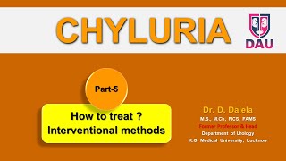 CHYLURIA treatment by interventional methods [upl. by Eanehs]