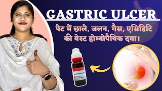 Gastric ulcer  पेट में छाले जलन बदहज़्मी की बेस्ट दवा  Peptic ulcer Treatment  Dr Arwa Bohra [upl. by Nai]