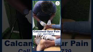 Calcaneal Spur Pain treatment  DrVijay Non Surgical  Chiropractic Treatment [upl. by Zacharias]