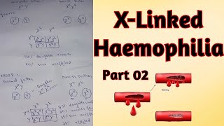 Genetics of X Linked Haemophilia disorder l Crossing of haemophilic couples lFor ClassXII and Mdcat [upl. by Suiratnod]