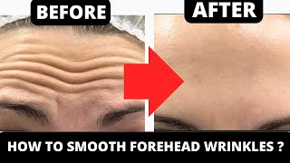 EFFECTIVE FACIAL EXERCISES FOR FOREHEAD WRINKLES  GET RID OF FOREHEAD LINES [upl. by Batista]