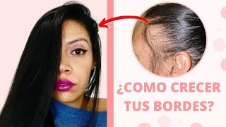 Cómo hacer CRECER el CABELLO de las ENTRADAS  RECUPERA EL PELO de LAS SIENES y zonas despobladas [upl. by Donohue133]