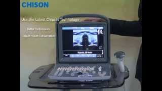 Chison ECO1 Introduction  Why its called ECO and Basic Functions [upl. by Crystal]