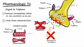 Migraines  Pathophysiology amp Treatment Described Concisely [upl. by Hubert]