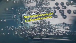 Nonlactose fermenting Escherichia coli growth on CLED Agar [upl. by Lorinda321]