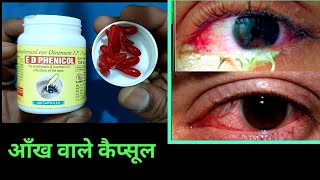 Chloramphenicol eye ointment uses in hindi आँखों के कैप्सूल aakhon ke capsules [upl. by Nenad]