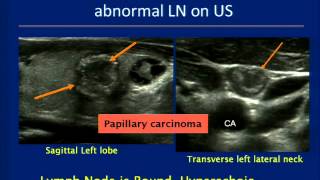 Thyroid Ultrasound Course [upl. by Moskow]