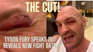 “THERE WILL BE NO RETIREMENT MUTHAFA” TYSON FURY SHOWS CUT amp CONFIRMS NEW DATE [upl. by Jessalyn]