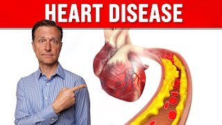 6 UNEXPECTED Signs of Heart Disease THAT YOU MUST KNOW [upl. by Richela449]