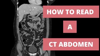 How to read a CT Abdomen for Med students and Residents  Part 1 [upl. by Assilla87]