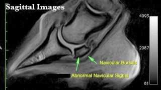 Standing MRI Information [upl. by Ydorb]