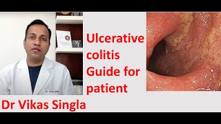 Ulcerative colitis Treatment and Symptoms अल्सरेटिव कोलाइटिस In Hindi Dr Vikas Singla [upl. by Medardas]