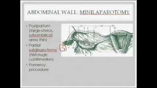 surgical sterilization  description indications and questions [upl. by Orfinger]