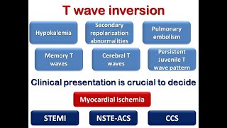 ECG course T wave inversion Dr Sherif Altoukhy [upl. by Aihsekan365]