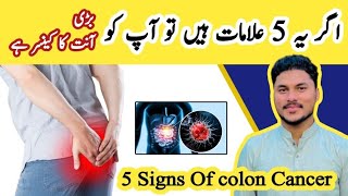 5 Warning Signs of Colon Cancer  Don’t Ignore These SymptomsColonCancer [upl. by Harve610]