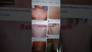 Rash free cream uses itching rashes allergy vasunthacreations [upl. by Tia491]