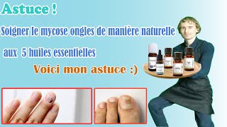 Lhuile essentielle ultime pour des soins complets et durables contre la mycose des ongles [upl. by Helsell]