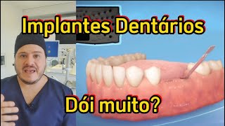 Implantes Dentários Passo a Passo  Instalação de Implantes [upl. by Henn]