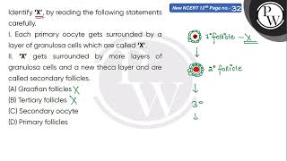 Identify lsquoXrsquo by reading the following statements carefully\nI Each primary oocyte g [upl. by Viradis833]