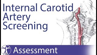 Carotid Artery Insufficiency  PreManipulative Screening [upl. by Allina]