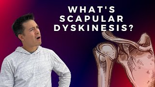 Scapular Dyskinesis and Shoulder Pain [upl. by Arem]