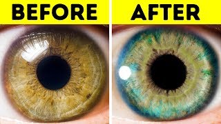 7 Things That Can Change Your Eye Color [upl. by Horst]