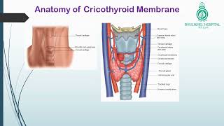 Cricothyroidotomy [upl. by Pia]