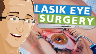 Lasik Eye Surgery [upl. by Dobson366]