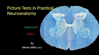 Picture Test in Neuroanatomy Spinal Cord 2 [upl. by Kcirdehs]