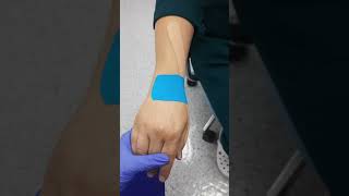 Taping for De quervains tenosynovitis [upl. by Cosenza]