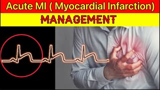 Acute MIMyocardial Infarction Management  Acute STEMI Management  Heart Attack Management in ER [upl. by Nerdna]