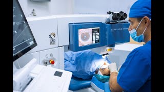 Prednosti SmartFEMTO LASIK procedure laserskog skidanja dioptrije [upl. by Reisch662]