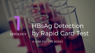 HBsAg Detection by Rapid Card Test [upl. by Soirtimid]