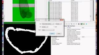 Cortical bone 1 periosteal and endosteal parameters [upl. by Enamrahc]