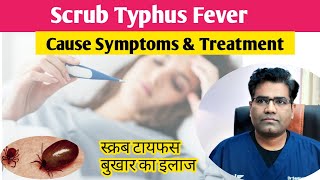 Scrub Typhus Cause Symptoms and Treatment Explained  स्क्रब टाइफस बुखार क्या है [upl. by Lodnar]