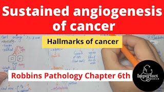 Sustained Angiogenesis of Cancer Hallmarks of Cancer neoplasia pathology robbins cancer [upl. by Myranda573]