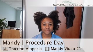 Traction Alopecia Regrowth  Alopecia Cure Natural Mandy [upl. by Douglas296]