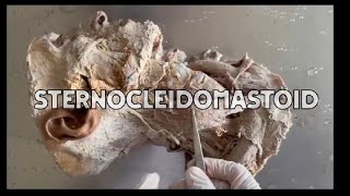 Muscle of head and neck sternocleidomastoid muscle hnf dissection anatomy [upl. by Aime]