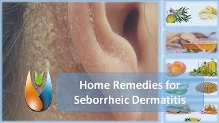 Home Remedies for Seborrheic Dermatitis [upl. by Gabler]