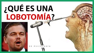 ¿Qué es una LOBOTOMIA Funciónes de la Lobotomía Cerebral [upl. by Laine]