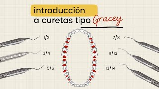 Intro Curetas tipo Gracey [upl. by Trace199]