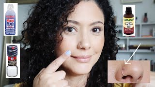 How to get rid of Nose piercing bump Home remedy [upl. by Remark]