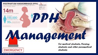 Post Partum Haemorrhage PPH Management  RCOG guidelines Educational guide [upl. by Jedidiah676]