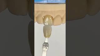 Another Perfectly Shaded Incisor EnvisiontecMain envisiontec lsk121shorts dentist [upl. by Duester]