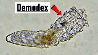 Live Demodex canis mite under microscope  10x magnification [upl. by Mendes]