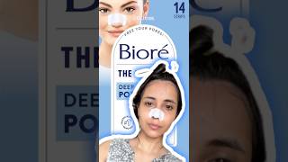 Blackheads whiteheads removal at home skincaregoals skincare Nosestrips shortsfeed pores [upl. by Johns]