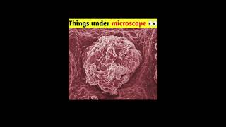 How Different Things Look Like Under A Microscope [upl. by Esorbma]