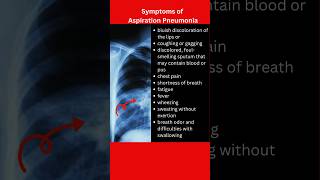 Symptoms of pneumonia pneumoniasymptoms pneumonia [upl. by Trula]