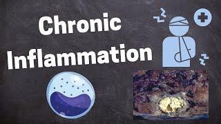 Pathology of Chronic Inflammation [upl. by Eenehs]