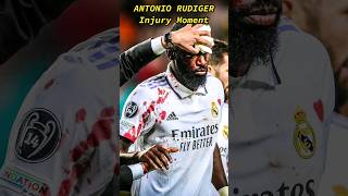 Antonio Rudiger injury moment😱😲 VREX EDITS [upl. by Honor364]